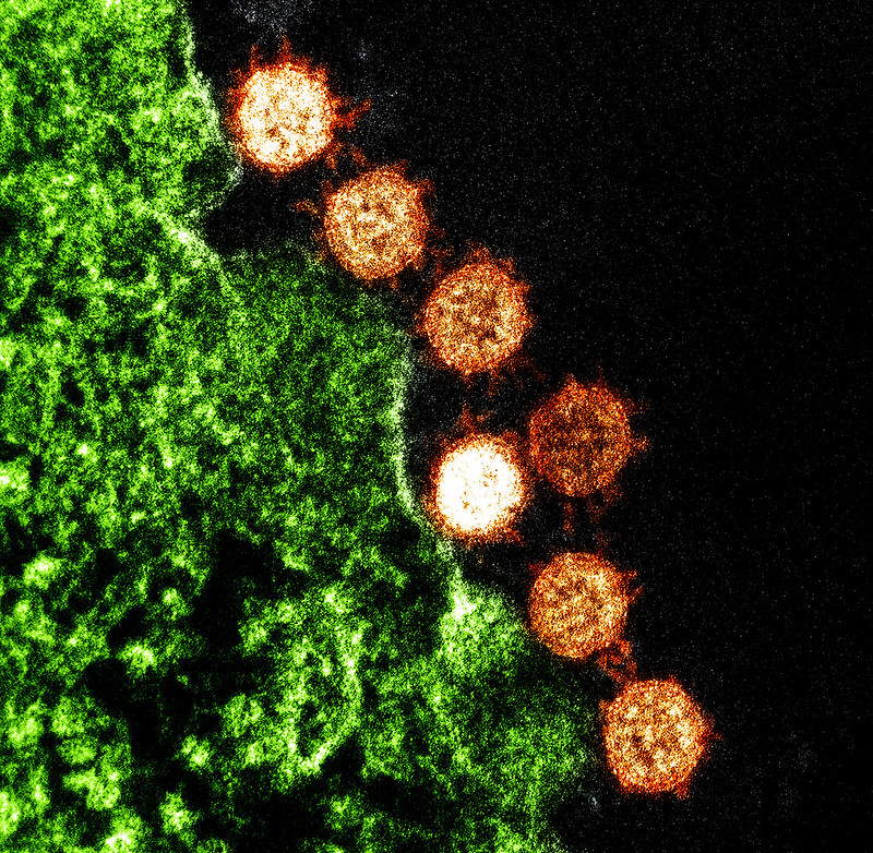 SARS virus particles. Red, round blobs on a black background.